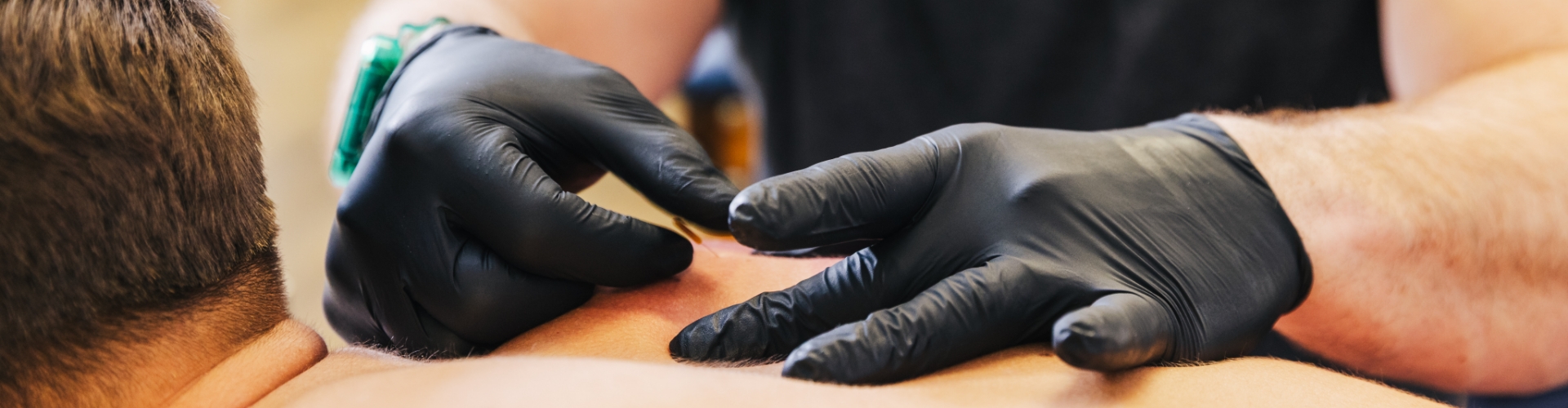 dry-needling-Foothills-Physical-Therapy-Group-Knoxville-TN-header