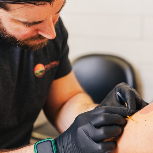 dry-needling-Foothills-Physical-Therapy-Group-Knoxville-TN