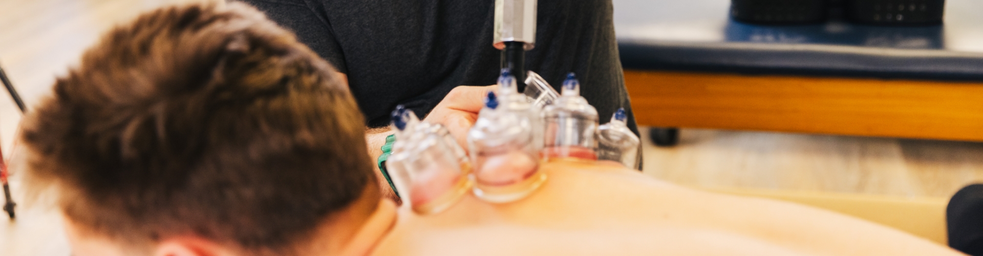 Myofascial Cupping
