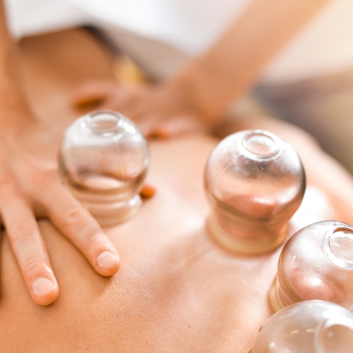 Myofascial-cupping-Summit-Bodyworks-At-Foothills-Knoxville-TN